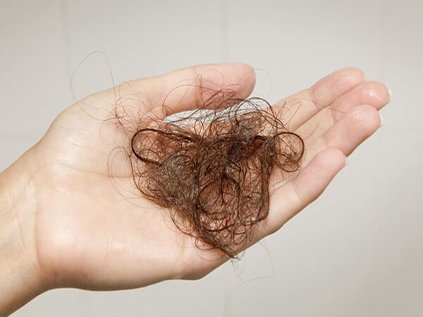 Bồ kết giúp ngăn ngừa rụng tóc